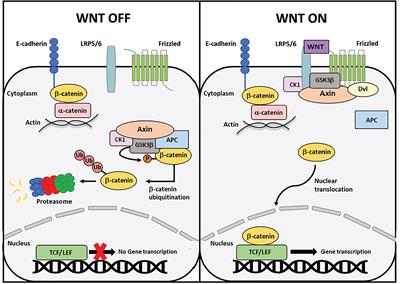 Mechanisms of mutant β-catenin in endometrial cancer progression